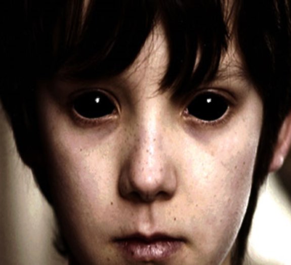 Mistério: você já ouviu falar das crianças com olhos completamente negros?