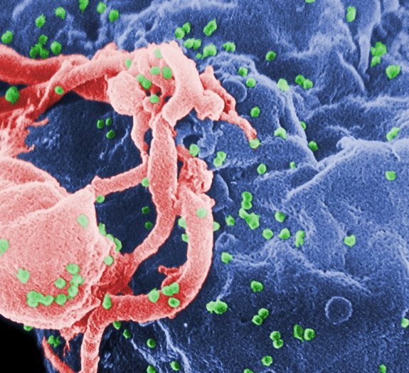 'Edição' no DNA pode ser arma contra o vírus da AIDS