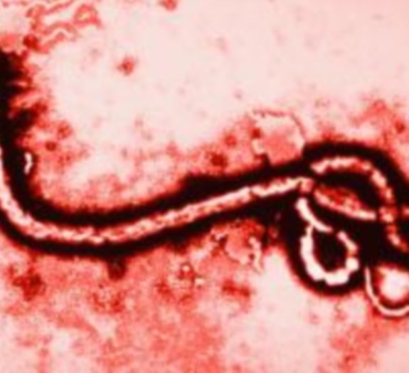 Nova epidemia de ebola na África é a pior já registrada no mundo