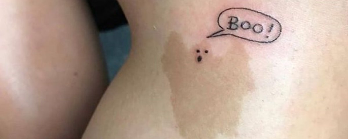 Mais 15 formas geniais de transformar sinais e cicatrizes com as tatuagens