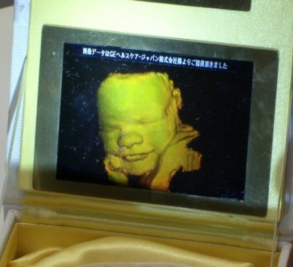 Empresa produz hologramas tridimensionais de fetos em gestação