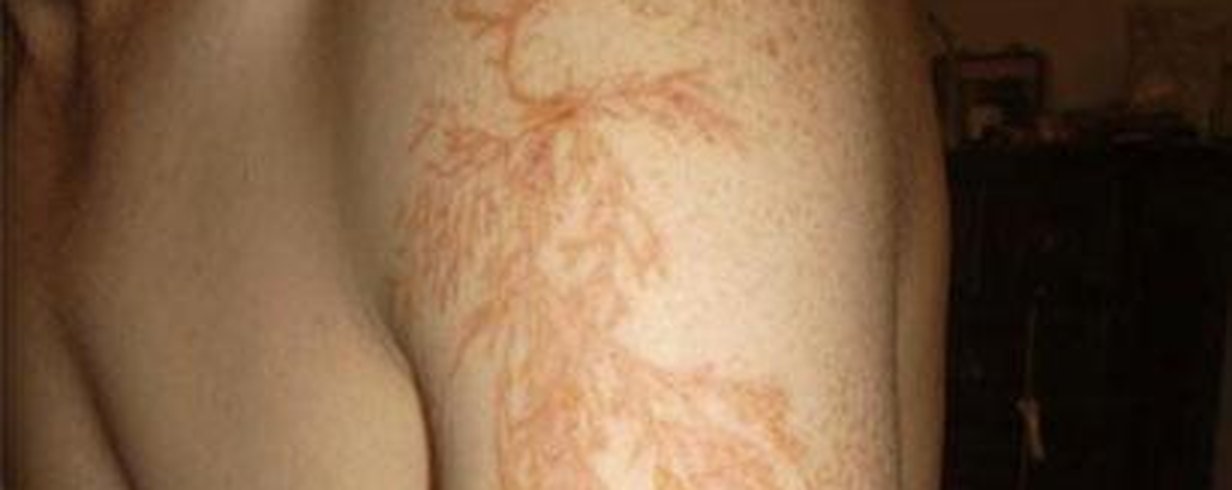 thumb-image-2024-02-29T13:56:51.634Z