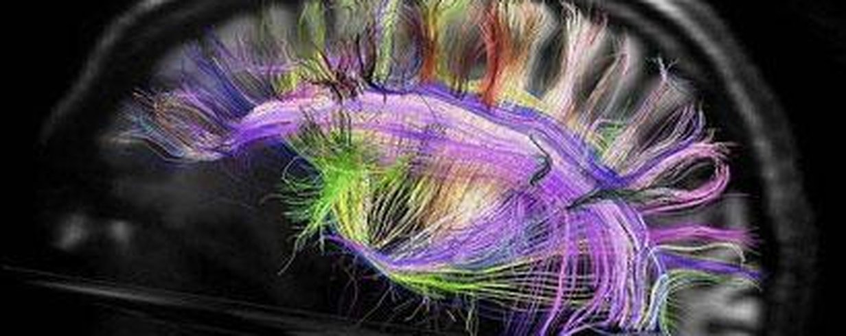 thumb-image-2024-02-29T13:56:52.785Z