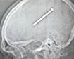 thumb-image-2024-02-29T13:56:55.466Z