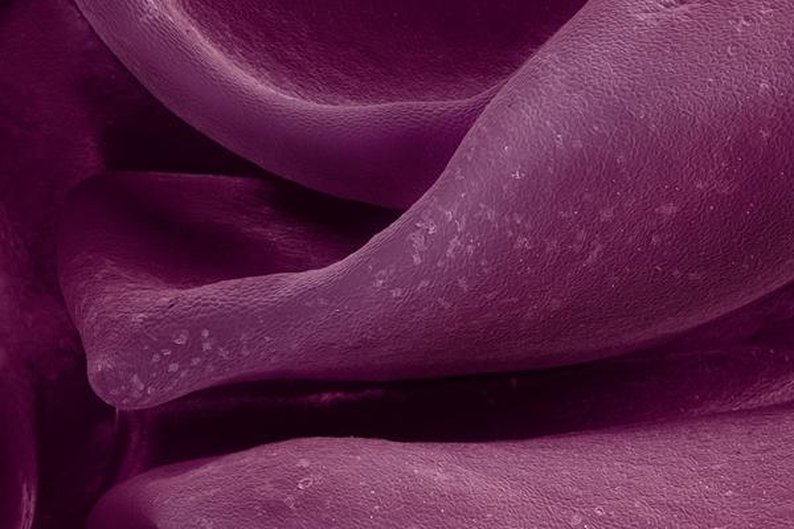 Repolho roxo