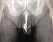 thumb-image-2024-02-29T13:57:44.616Z