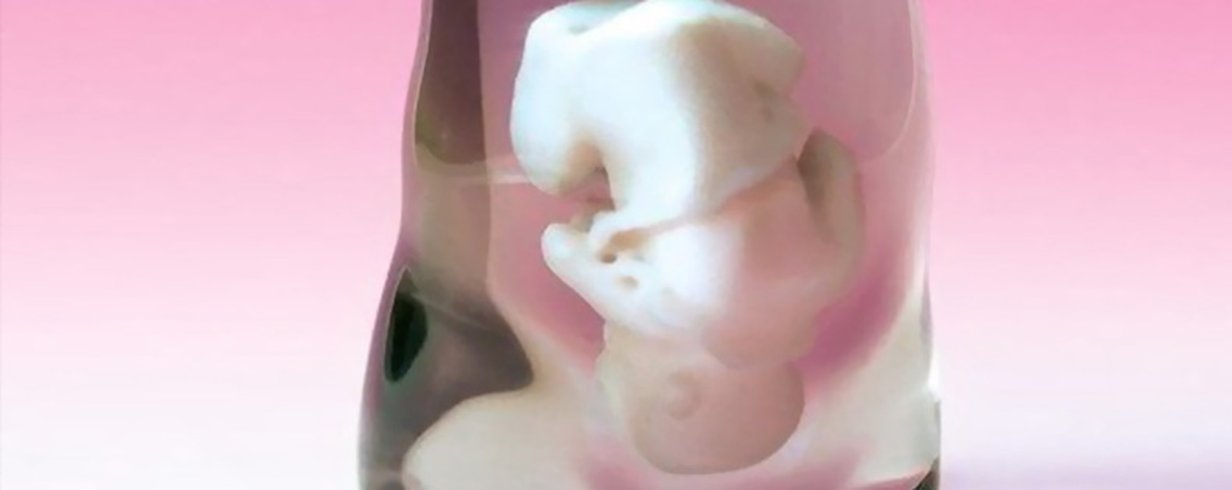 thumb-image-2024-02-29T13:57:04.201Z