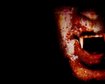 thumb-image-2024-02-29T13:57:20.635Z