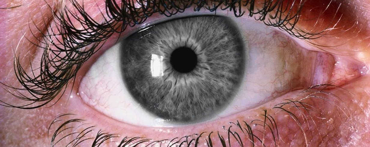 thumb-image-2024-02-29T13:57:23.444Z