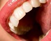 thumb-image-2024-02-29T13:57:28.264Z