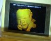 thumb-image-2024-02-29T13:57:30.637Z