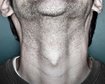 thumb-image-2024-02-29T13:57:37.575Z