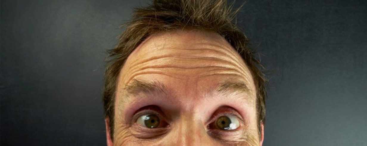 thumb-image-2024-02-29T13:58:28.881Z
