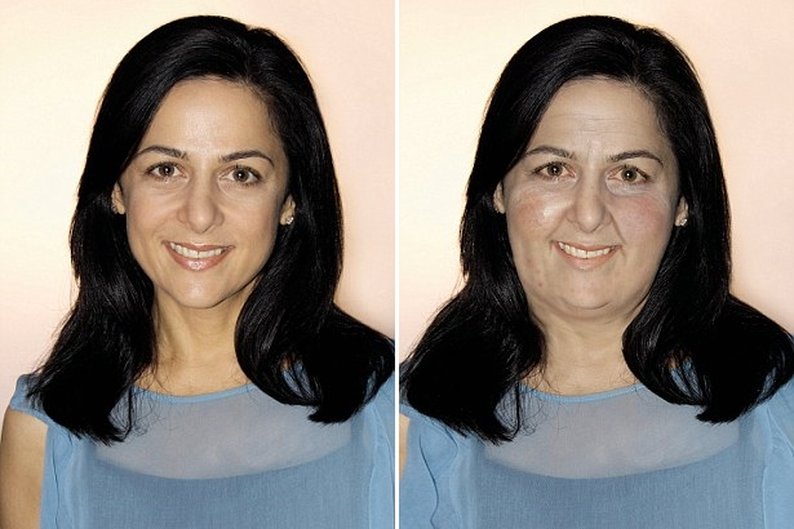 Anna Magge após ingerir grandes quantidades de carboidratos e junk food durante 10 anos.