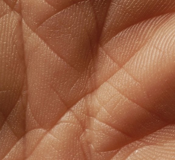 Células da pele podem detectar aromas que aceleram a regeneração de feridas