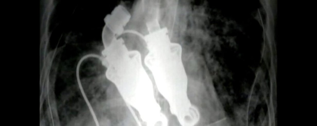 thumb-image-2024-02-29T13:58:48.754Z