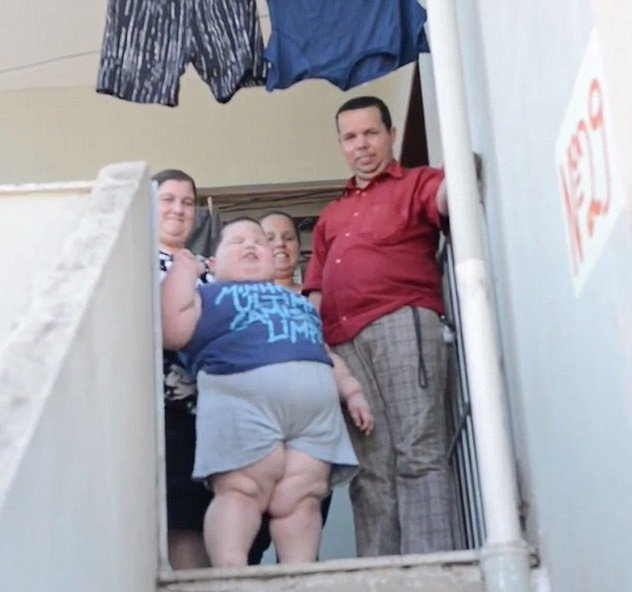 Garoto brasileiro não consegue parar de comer e, aos 3 anos, já pesa 70 kg