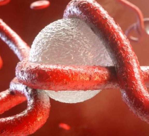 Ancestral do vírus ebola pode ter mais de 20 milhões de anos, diz estudo