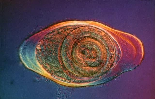 1976 – Pequeno parasita da espécie Trichinella spiralis encapsulado em um cisto clicado por Eric V. Gravé, de Nova York.