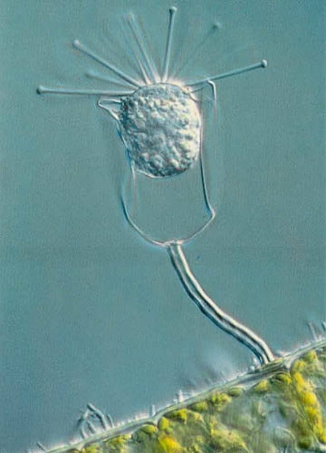 1979 – Protozoário preso a uma alga e com bactérias sobre sua superfície, capturado por Paul W. Johnson, da Universidade de Rhode Island, nos EUA.