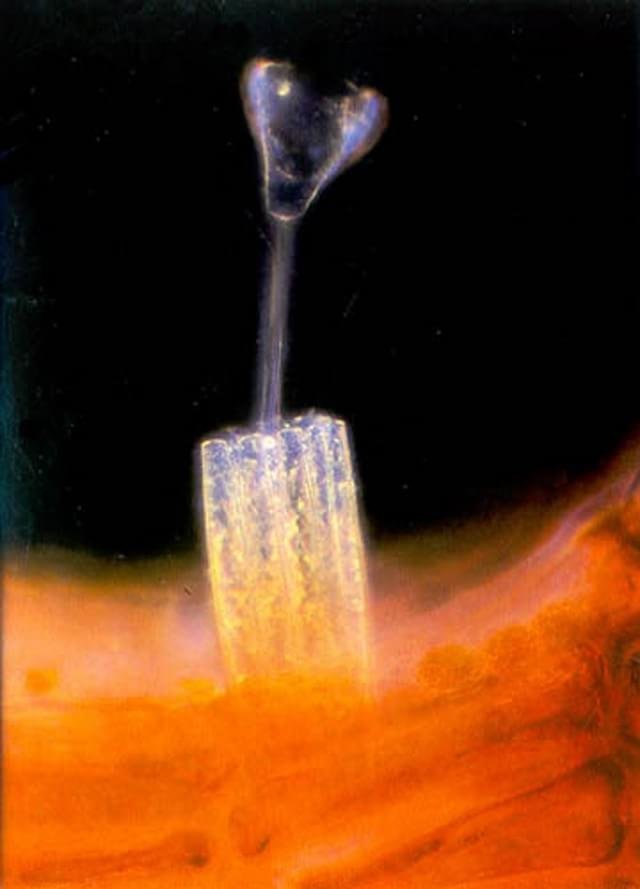 1983 – A imagem acima, clicada por Elieen Roux do Instituto Internacional de Pesquisa Cardíaca Bob Hope, mostra um protozoário da ordem Suctorida preso ao talo de uma alga vermelha rodeado por diatomáceas.