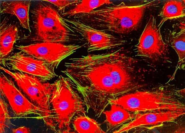 1998 – A imagem acima mostra células endoteliais (um tipo de célula que reveste o interior dos vasos sanguíneos), e foi clicada por Jakob Zbaeren do Hospital Universitário Inselspital Localizado em Bern, na Suíça.
