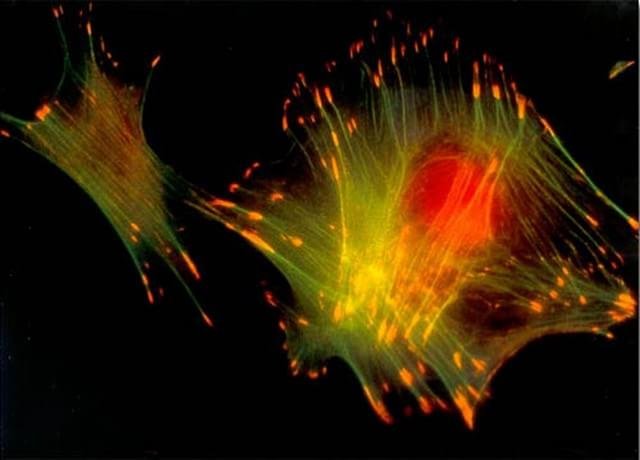 Fibroblastos (células do tecido conjuntivo responsáveis por sintetizar a elastina e o colágeno) de um rato fotografados por Barbara A. Danowski da Union College, dos EUA.
