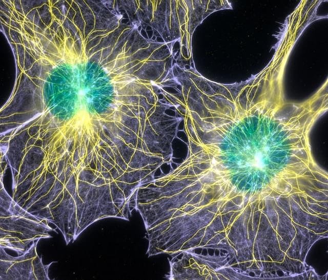 2003 – Actina filamentosa e microtúbulos de fibroblastos de ratinhos clicados por Torsten Wittmann do Scripps Research Institute dos EUA.