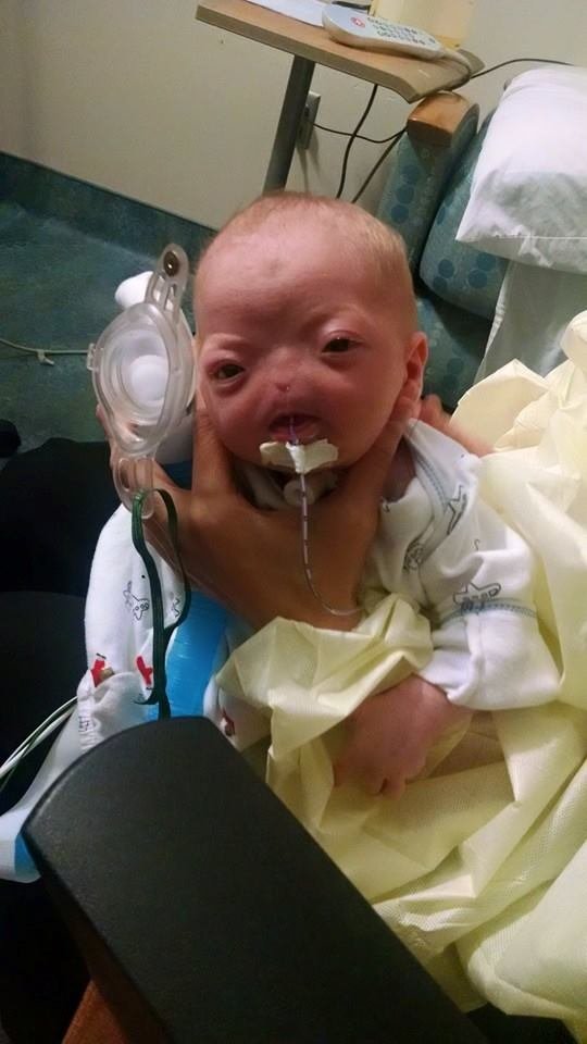 Nascimento de bebê sem nariz comove internautas em todo o mundo