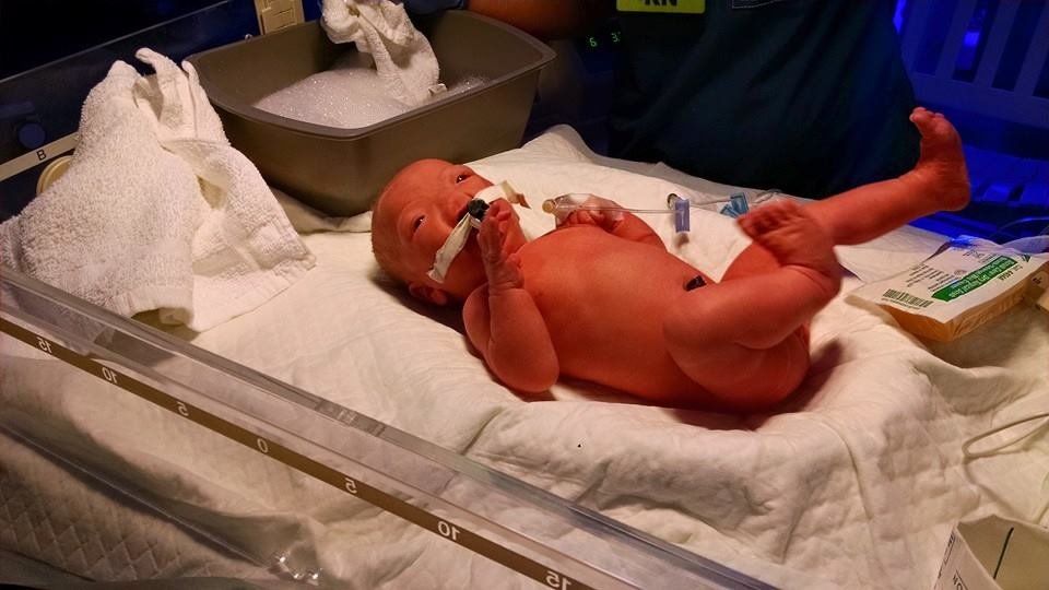 Nascimento de bebê sem nariz comove internautas em todo o mundo