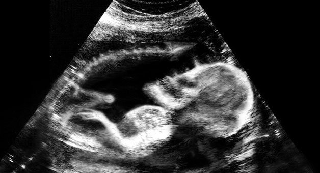 De dar medo: estes ultrassons farão você pensar 2 vezes antes de ter filhos