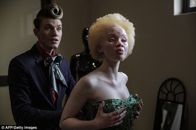 Do bullying para a vida de modelo: conheça a história de Thando Hopa