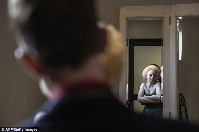 Do bullying para a vida de modelo: conheça a história de Thando Hopa
