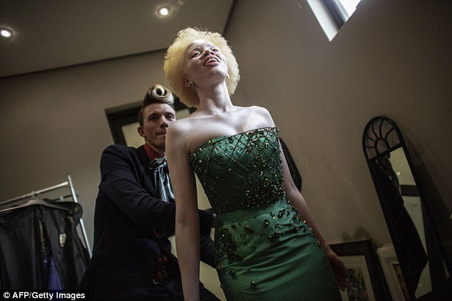Do bullying para a vida de modelo: conheça a história de Thando Hopa