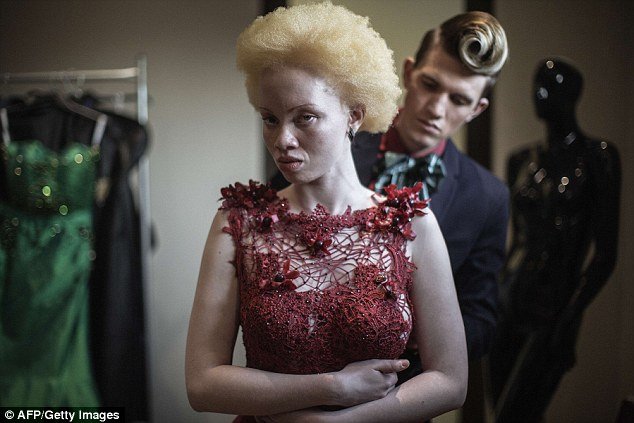 Do bullying para a vida de modelo: conheça a história de Thando Hopa