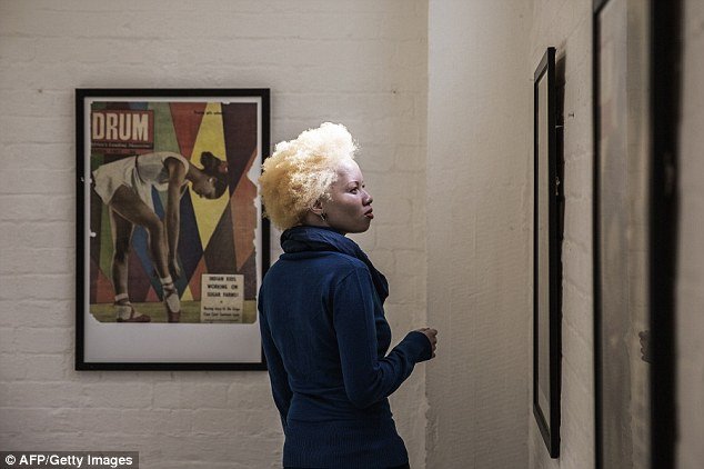 Do bullying para a vida de modelo: conheça a história de Thando Hopa