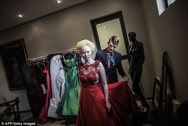 Do bullying para a vida de modelo: conheça a história de Thando Hopa