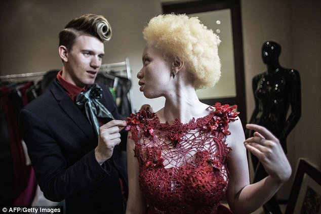 Do bullying para a vida de modelo: conheça a história de Thando Hopa