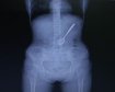 thumb-image-2024-02-29T13:59:38.436Z