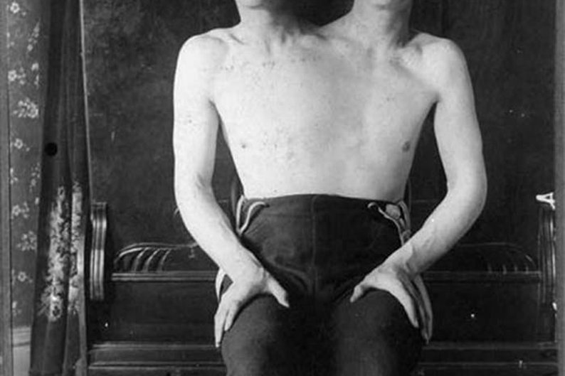 O homem de duas cabeças