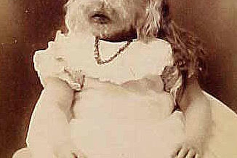 Alice Doherty, o “bebê peludo”