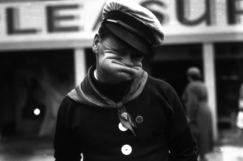 O contorcionista facial, Alfred Hyland
