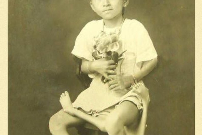 Maxine Mina, a “menina de quatro pernas”