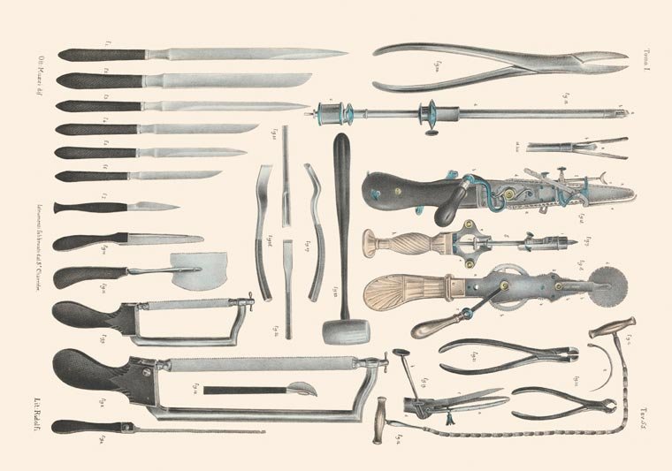 Impressionante! Veja ilustrações de cirurgias feitas no século 19