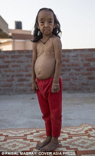 Irmãos indianos sofrem de condição rara que os faz parecerem velhinhos