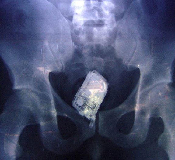 Os 13 raios X mais inacreditáveis divulgados pelos médicos
