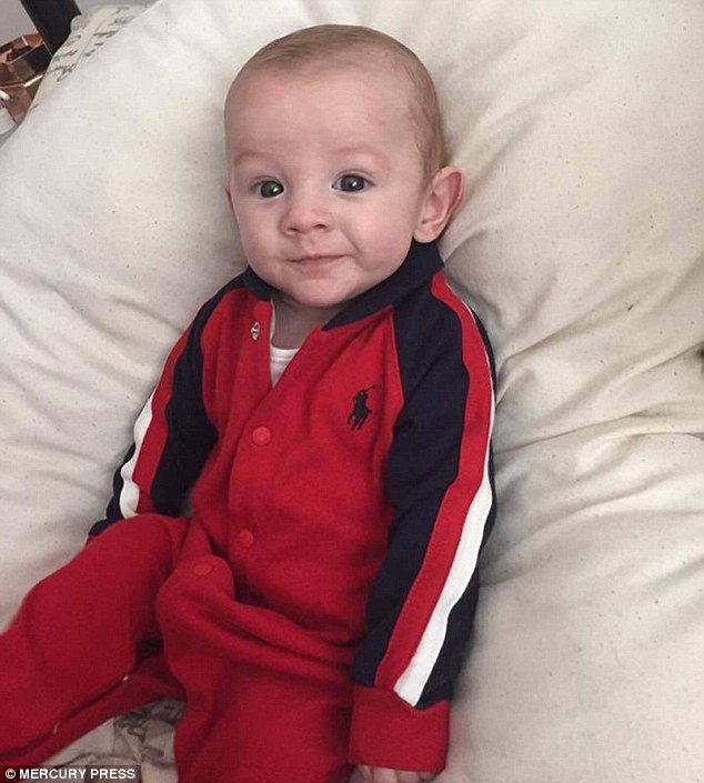 Milagre da medicina: bebê sobrevive mesmo nascendo com intestino para fora