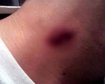 thumb-image-2024-02-29T14:01:57.968Z