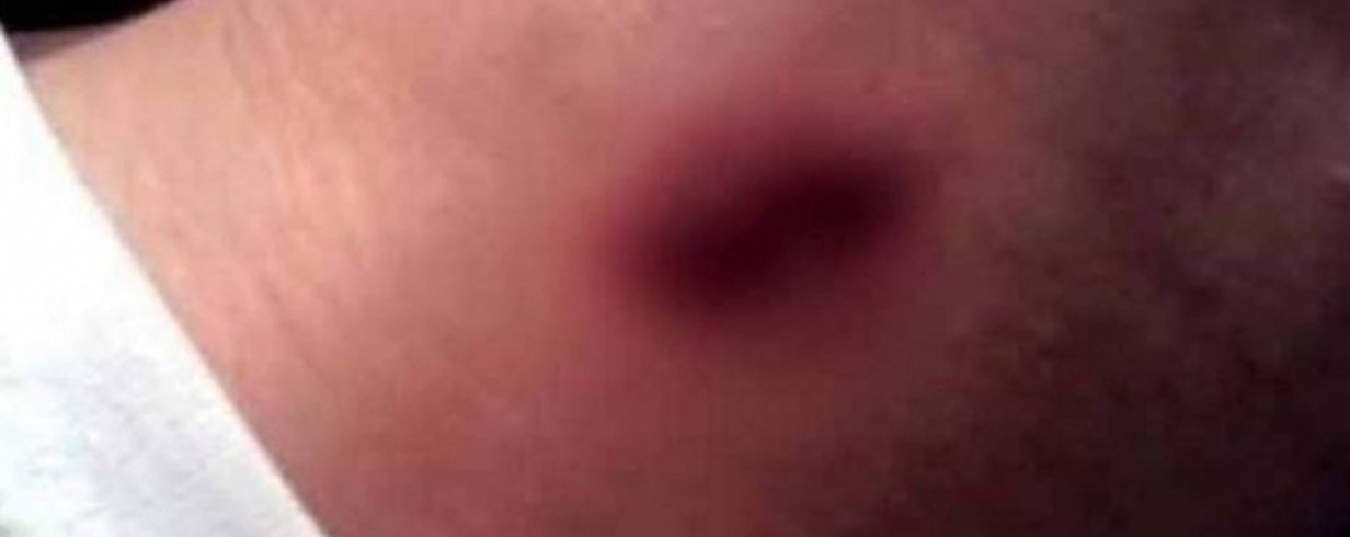 thumb-image-2024-02-29T14:01:57.968Z