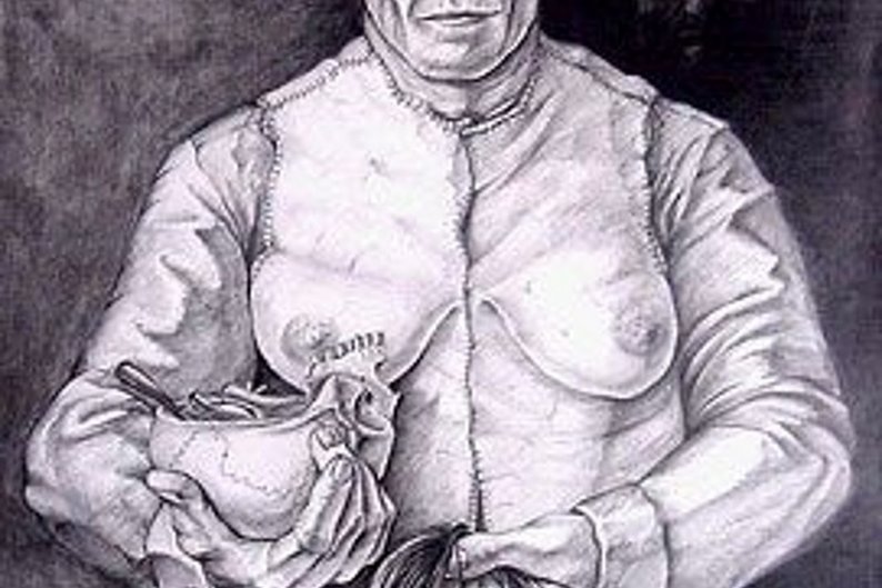 Ilustração que mostra a